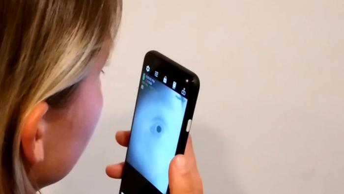 Des chercheurs de l'Université de Californie à San Diego disent avoir développé une application pour smartphone qui pourrait dépister les utilisateurs pour des maladies neurologiques, telles que la maladie d'Alzheimer ou le TDAH, en scannant leur œil.