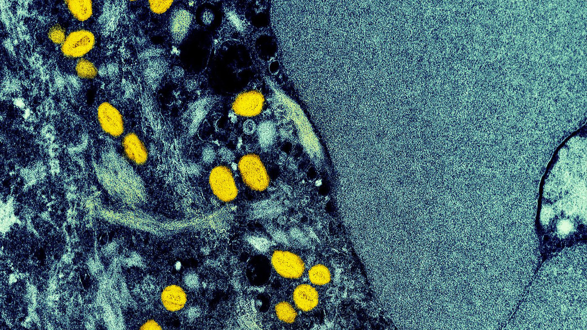 Une micrographie électronique à transmission colorisée de particules de monkeypox (jaune) trouvées dans une cellule infectée (bleue) est montrée dans une photo prise au NIAID Integrated Research Facility (IRF) à Fort Detrick, Maryland.