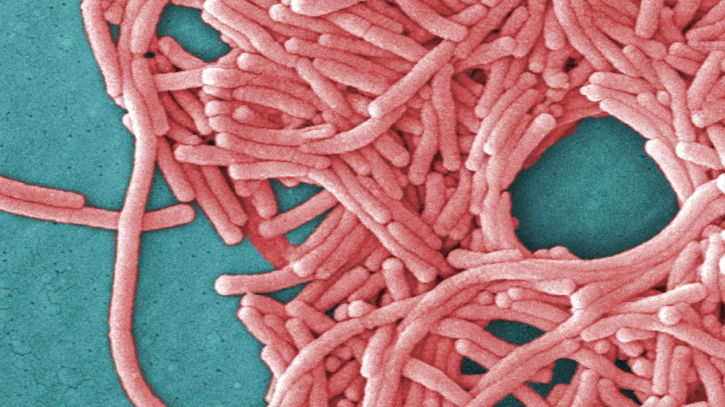 Cette image fournie par les Centers for Disease Control and Prevention montre un grand groupe de bactéries Gram-négatives Legionella pneumophila. 