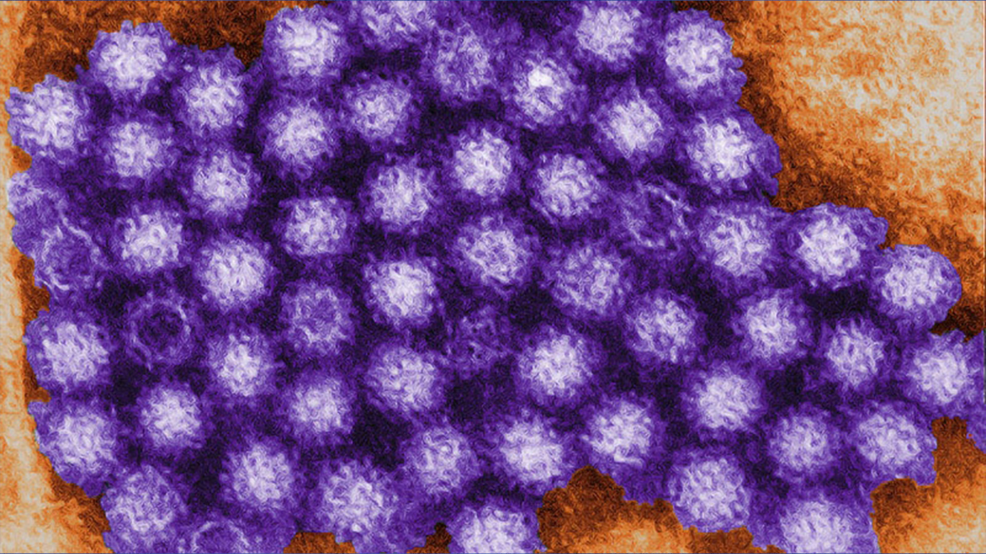Cette micrographie électronique à transmission (TEM) des Centers for Disease Control basés aux États-Unis montre des virions de norovirus ou des particules virales.