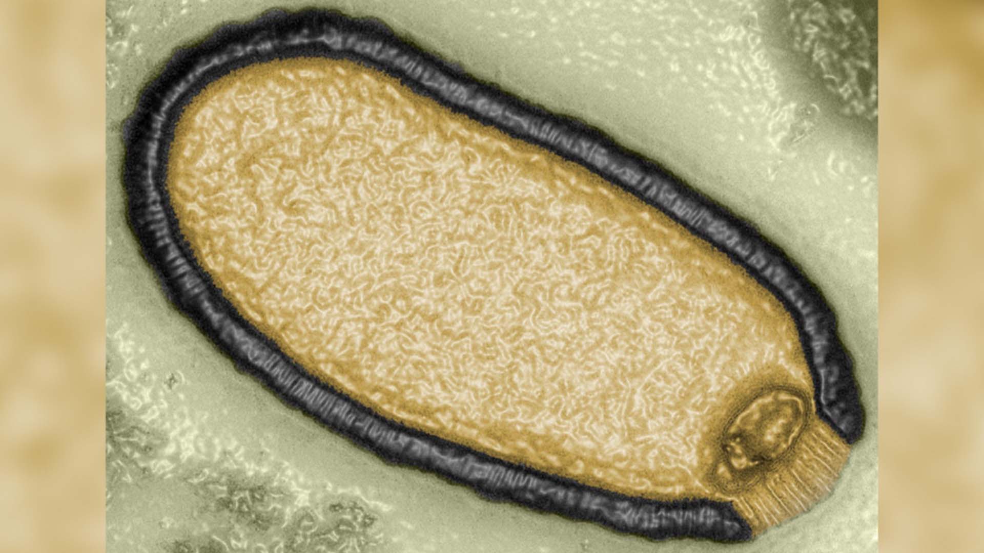 Des scientifiques ont découvert un virus «zombie» qui avait passé 48 500 ans congelé dans le pergélisol.