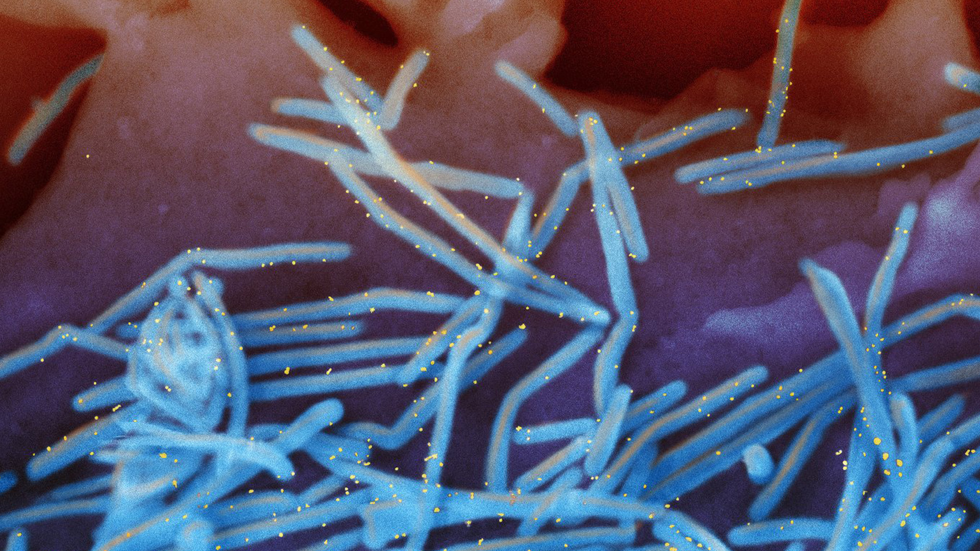 Cette image au microscope électronique fournie par les National Institutes of Health montre des virions du virus respiratoire syncytial humain (VRS), colorisés en bleu, et des anticorps anti-RSV F protéine/or, colorisés en jaune, excrétés à la surface des cellules pulmonaires humaines.
