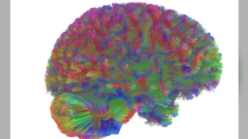 L'adolescence jusqu'à 32 ans? Le cerveau passe par cinq phases au cours de sa vie, selon une étude