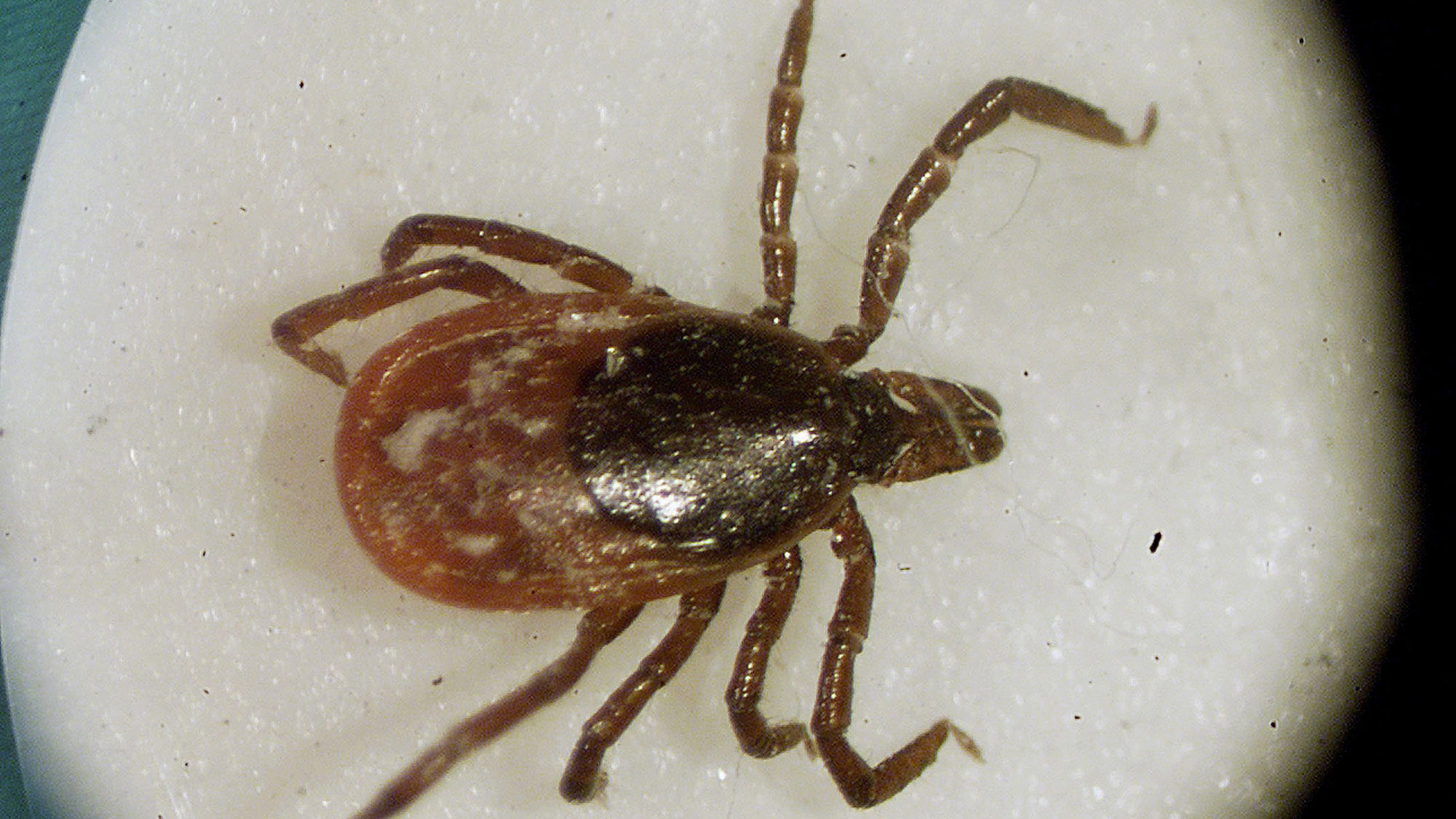 A blacklegged tick is shown under a microscope in a lab at the University of Rhode Island in South Kingstown, R.I. , in 2002. (Victoria Arocho / AP Photo)
