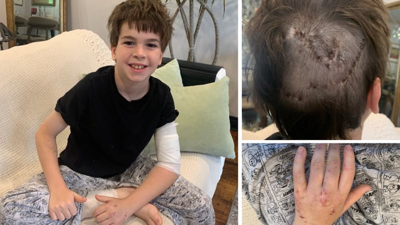 «J’ai cru que j’allais mourir»: attaqué par un chien, un jeune de 11 ans brise le silence